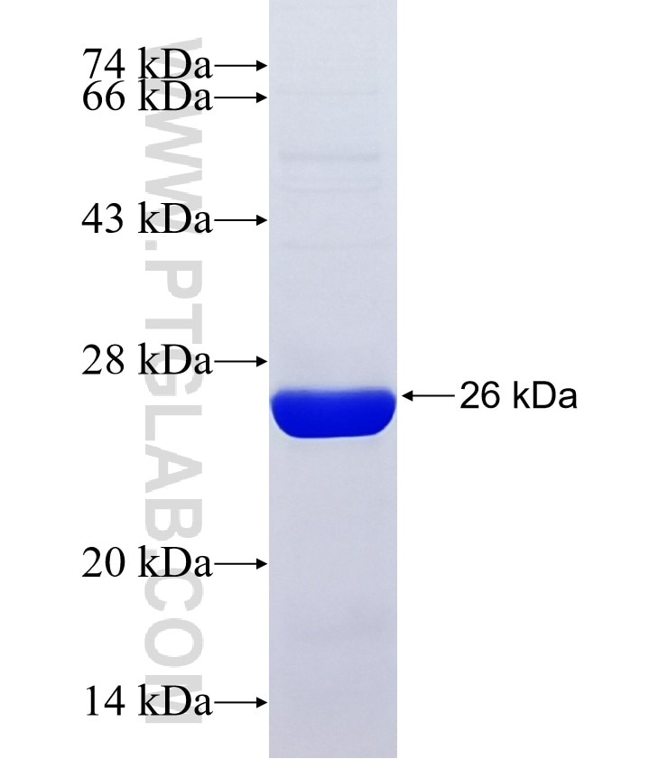 C9orf114 fusion protein Ag37825 SDS-PAGE C9orf114 fusion protein Ag37825 SDS-PAGE