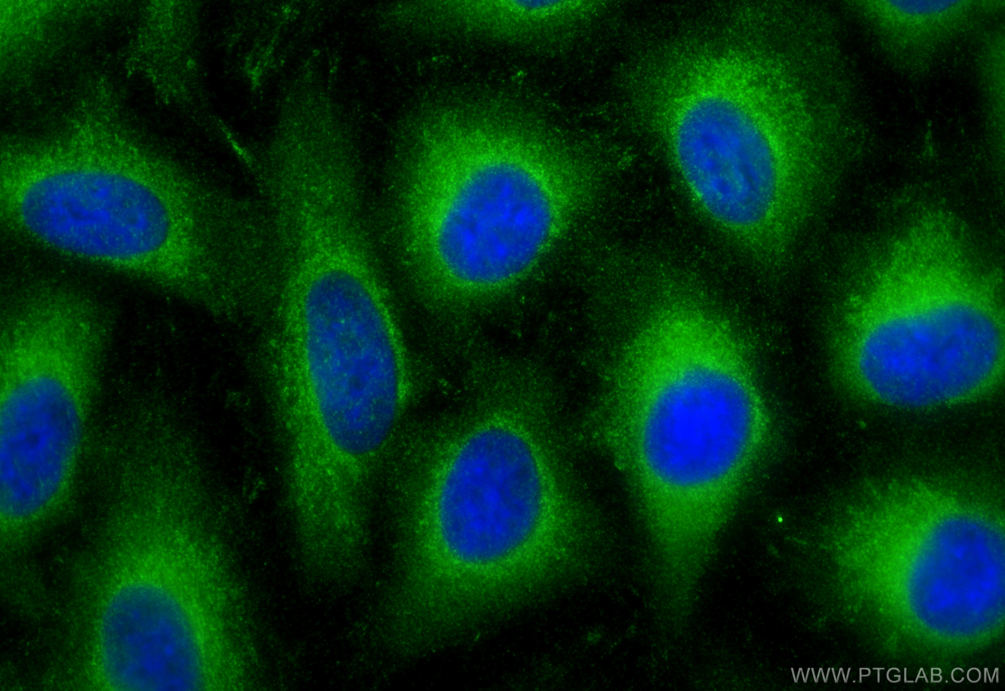 Immunofluorescence (IF) / fluorescent staining of A549 cells using C9orf117 Polyclonal antibody (21012-1-AP)