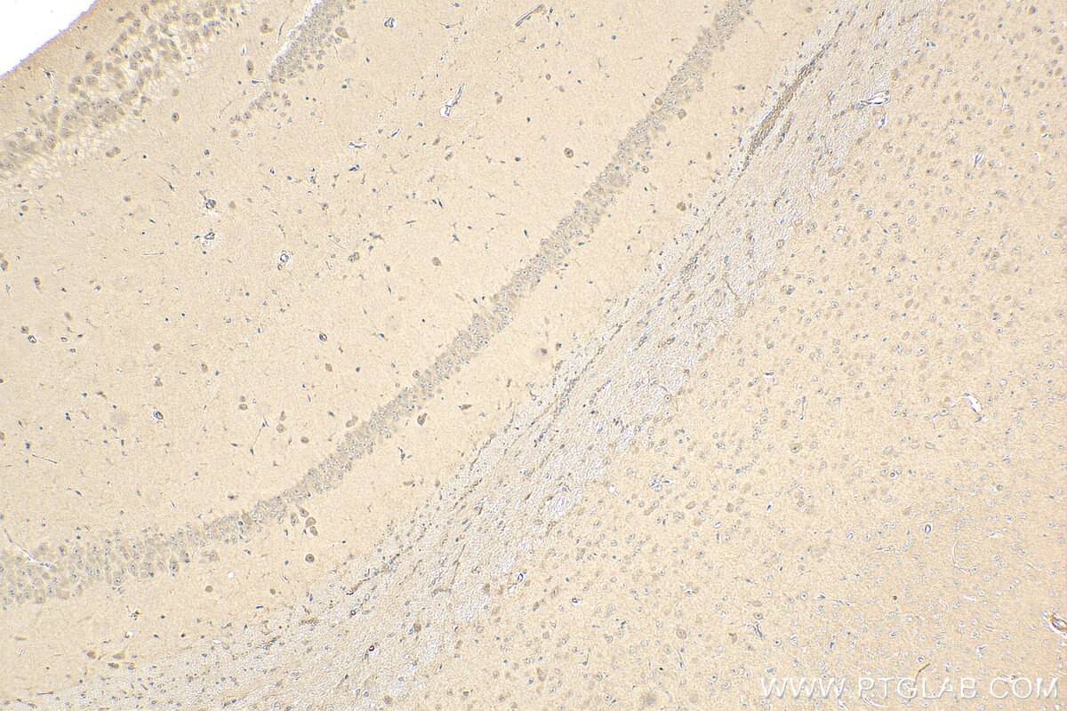 Immunohistochemistry (IHC) staining of mouse brain tissue using C9orf117 Polyclonal antibody (21012-1-AP)