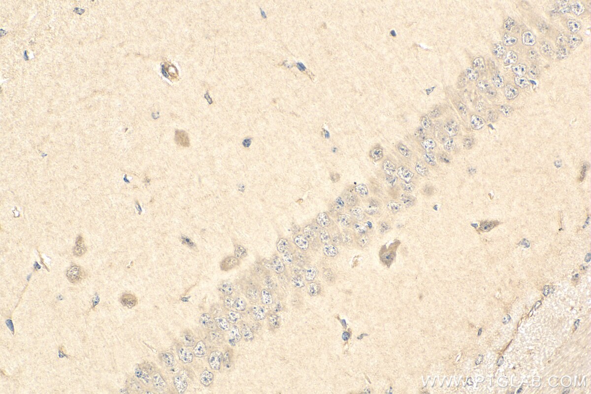 Immunohistochemistry (IHC) staining of mouse brain tissue using C9orf117 Polyclonal antibody (21012-1-AP)