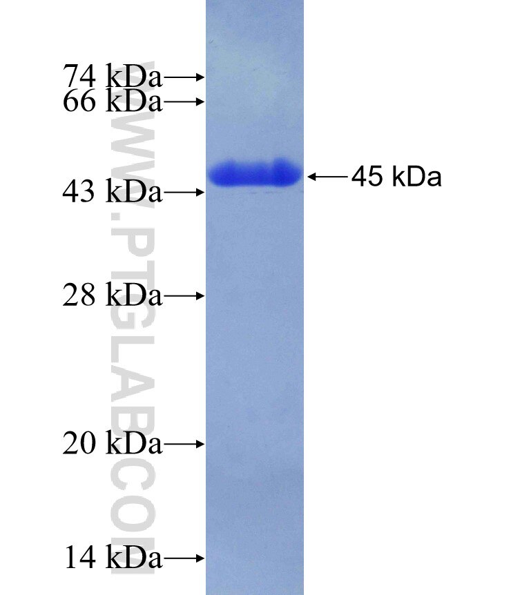 C9orf125 fusion protein Ag29793 SDS-PAGE