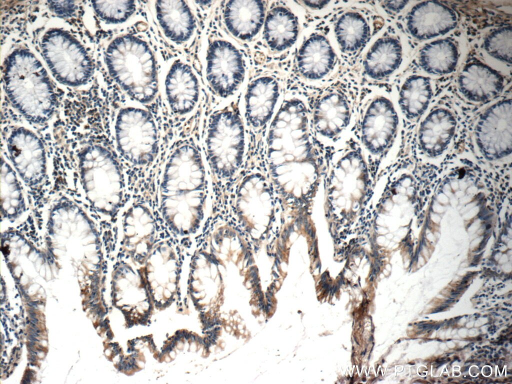 IHC staining of human colon using 21593-1-AP