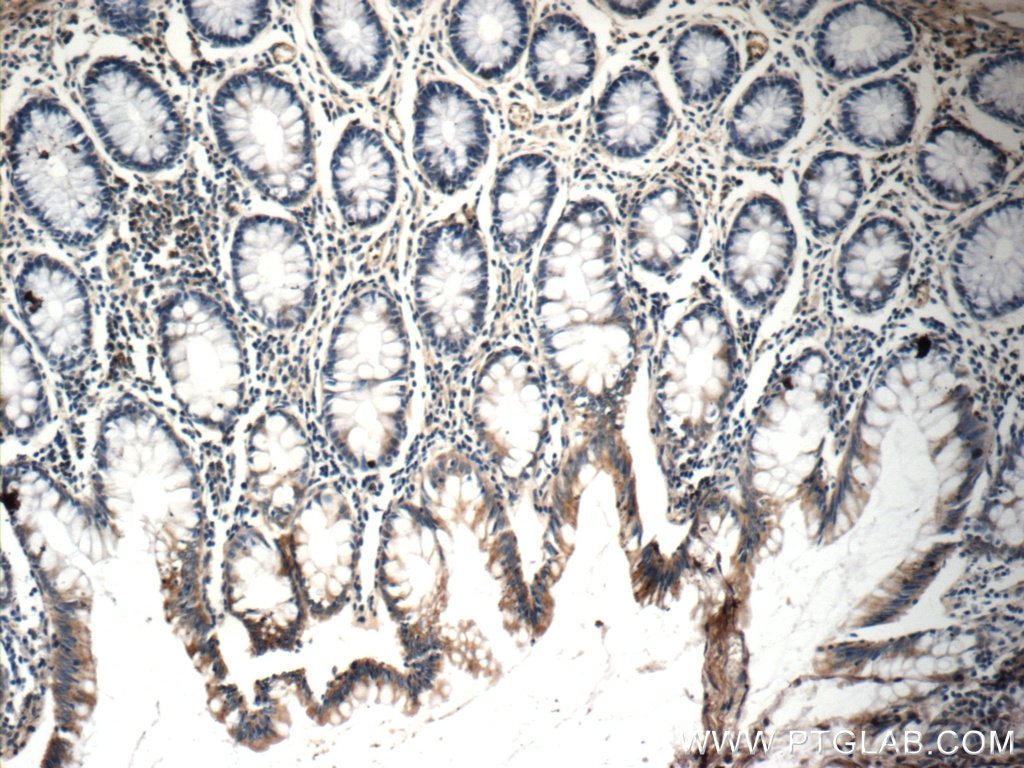 Immunohistochemistry (IHC) staining of human colon tissue using NGX6 Polyclonal antibody (21593-1-AP)