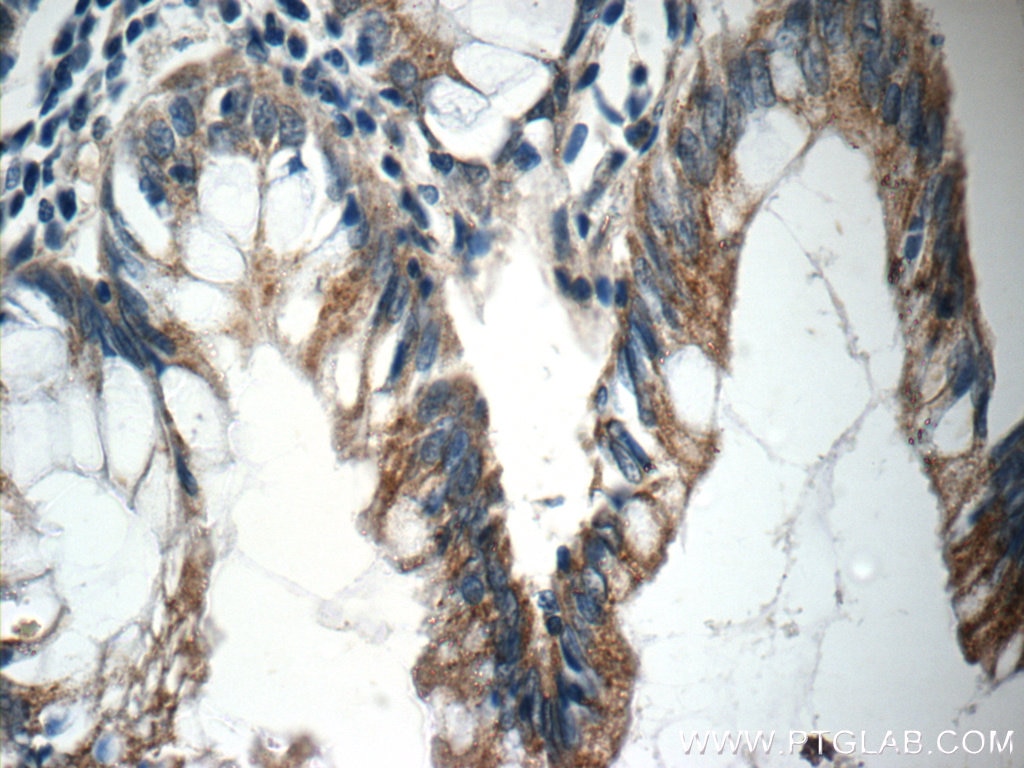 Immunohistochemistry (IHC) staining of human colon tissue using NGX6 Polyclonal antibody (21593-1-AP)