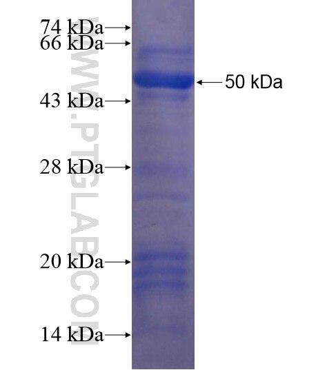C9orf128 fusion protein Ag19661 SDS-PAGE