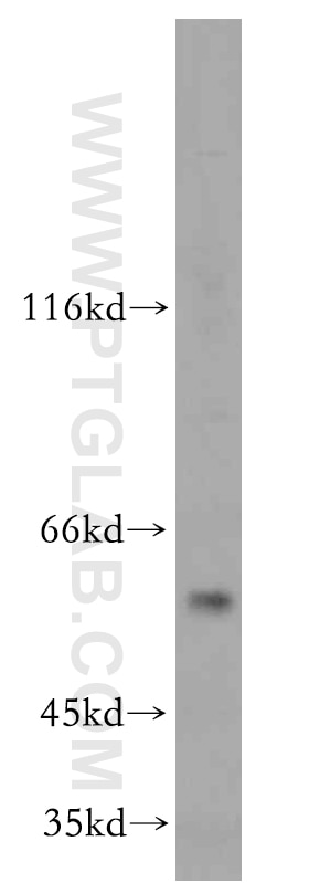 Western Blot (WB) analysis of HepG2 cells using C9orf156 Polyclonal antibody (20475-1-AP)