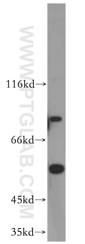 Western Blot (WB) analysis of HeLa cells using C9orf156 Polyclonal antibody (20475-1-AP)