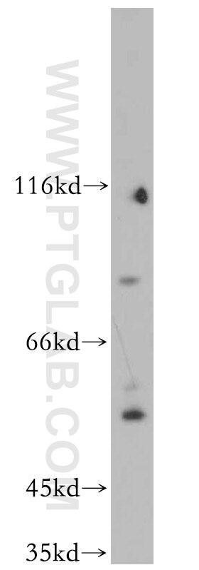 Western Blot (WB) analysis of Jurkat cells using C9orf156 Polyclonal antibody (20475-1-AP)