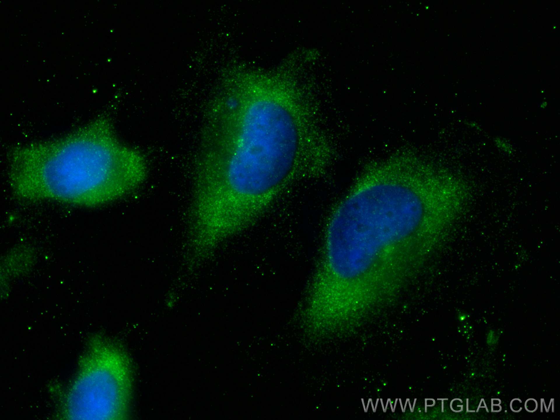 Immunofluorescence (IF) / fluorescent staining of U-251 cells using C9orf171 Polyclonal antibody (24969-1-AP)