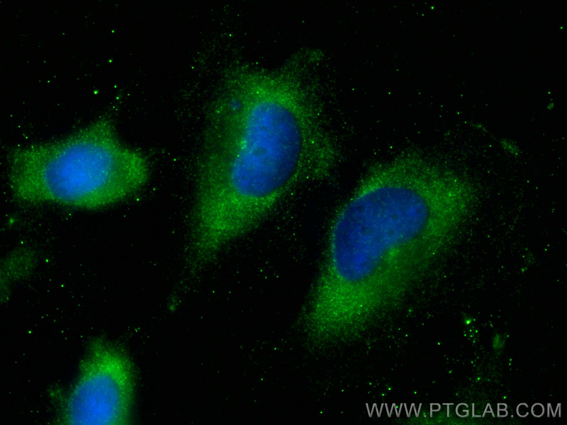 IF Staining of U-251 using 24969-1-AP