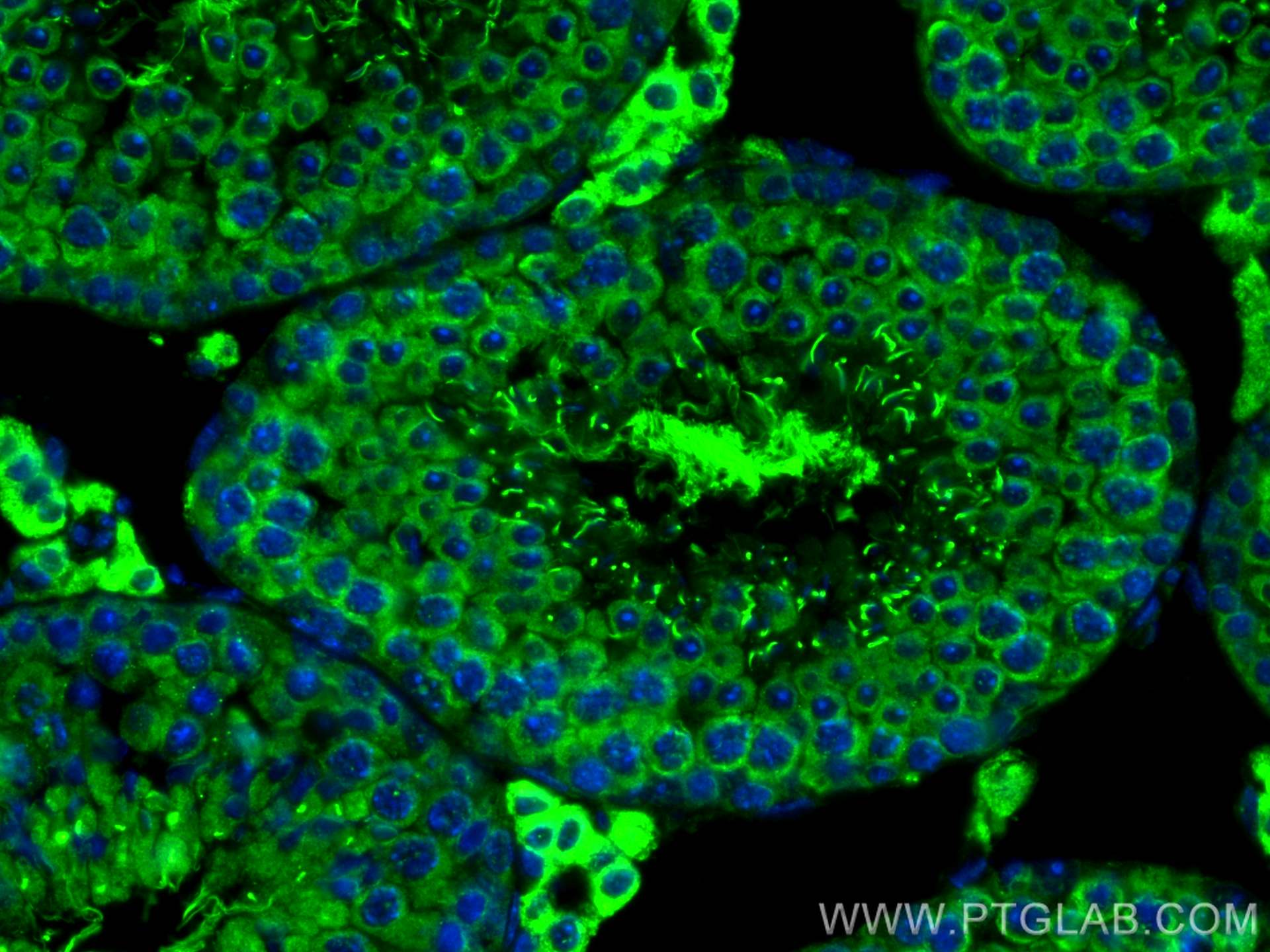 Immunofluorescence (IF) / fluorescent staining of mouse testis tissue using C9orf171 Polyclonal antibody (24969-1-AP)