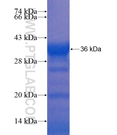 C9orf171 fusion protein Ag21797 SDS-PAGE