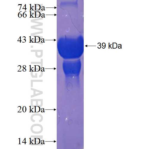 C9orf25 fusion protein Ag23771 SDS-PAGE