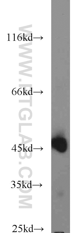 Western Blot (WB) analysis of HepG2 cells using C9orf41/CARNMT1 Polyclonal antibody (24068-1-AP)