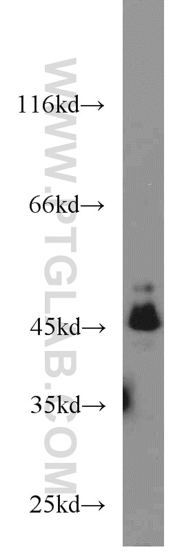 Western Blot (WB) analysis of HeLa cells using C9orf41/CARNMT1 Polyclonal antibody (24068-1-AP)