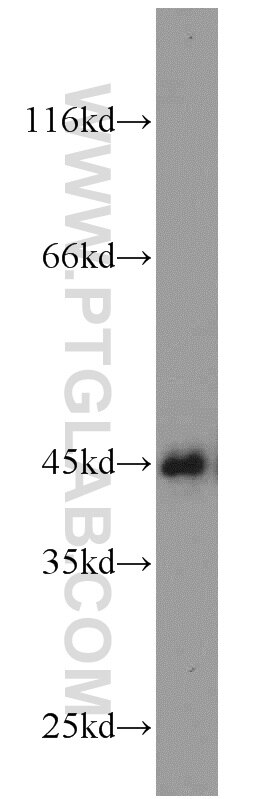 Western Blot (WB) analysis of MCF-7 cells using C9orf41/CARNMT1 Polyclonal antibody (24068-1-AP)