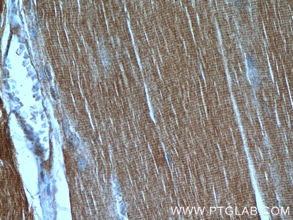 Immunohistochemistry (IHC) staining of human skeletal muscle tissue using C9orf61 Polyclonal antibody (25630-1-AP)