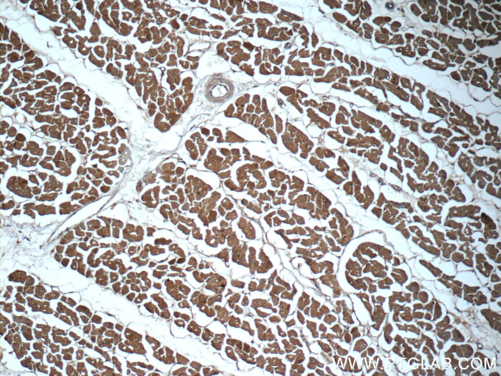 Immunohistochemistry (IHC) staining of human heart tissue using C9orf61 Polyclonal antibody (25630-1-AP)