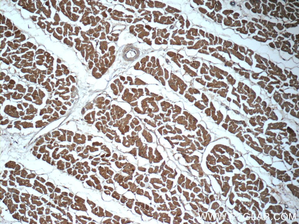 IHC staining of human heart using 25630-1-AP