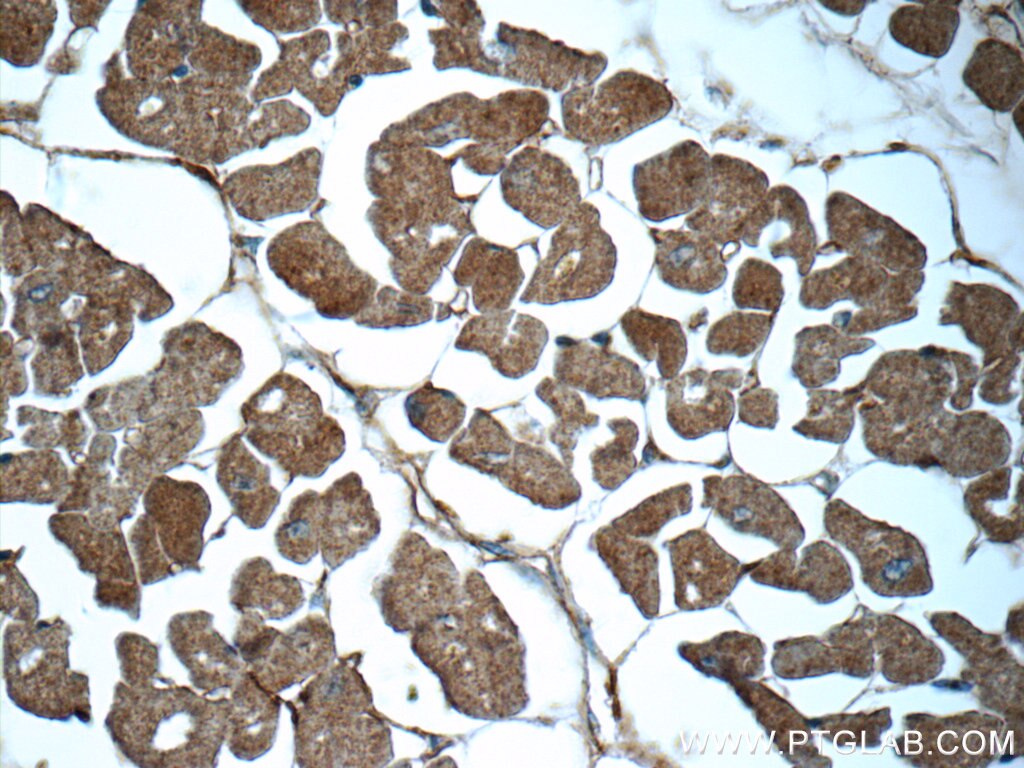 Immunohistochemistry (IHC) staining of human heart tissue using C9orf61 Polyclonal antibody (25630-1-AP)