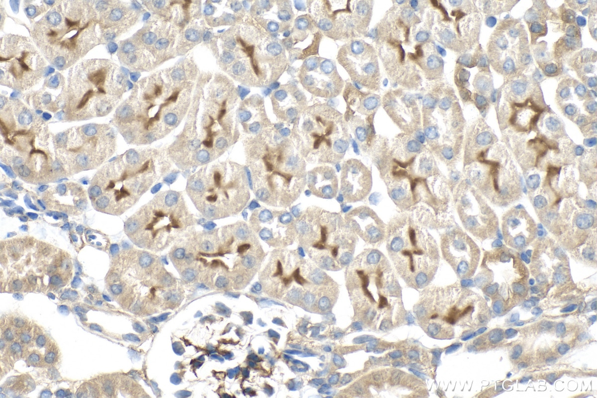 Immunohistochemistry (IHC) staining of mouse kidney tissue using C9orf71 Polyclonal antibody (30509-1-AP)