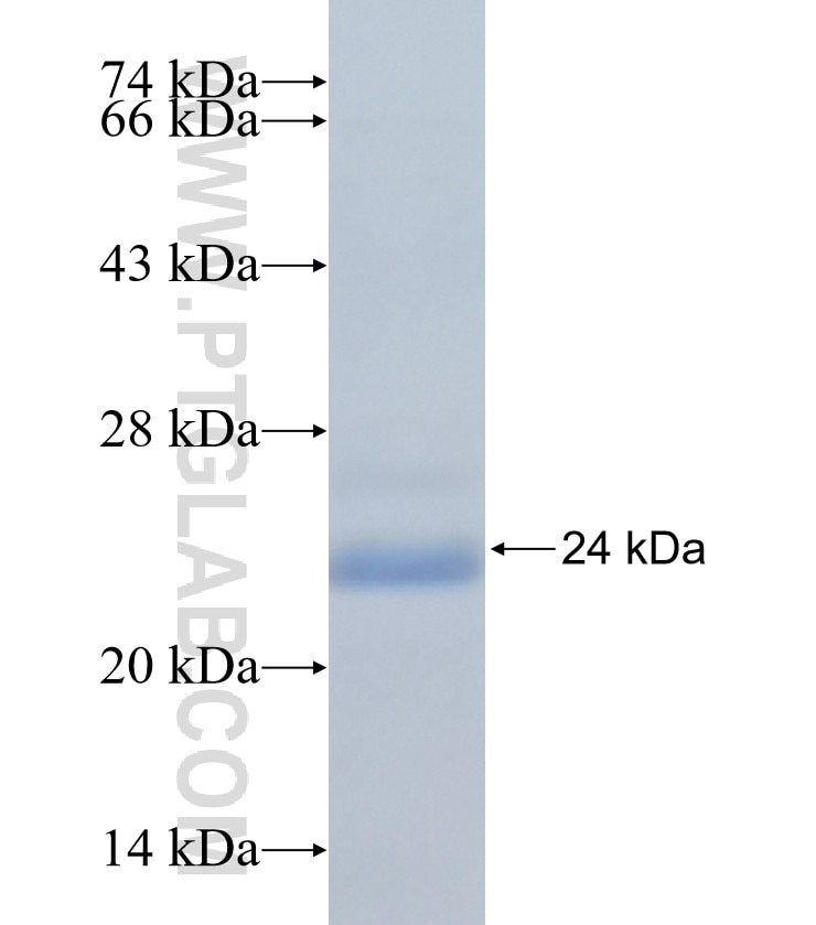 C9orf71 fusion protein Ag33081 SDS-PAGE C9orf71 fusion protein Ag33081 SDS-PAGE