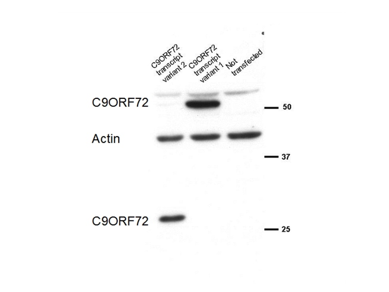 Western Blot (WB) analysis of transfected cells using C9orf72 Polyclonal antibody (22637-1-AP)