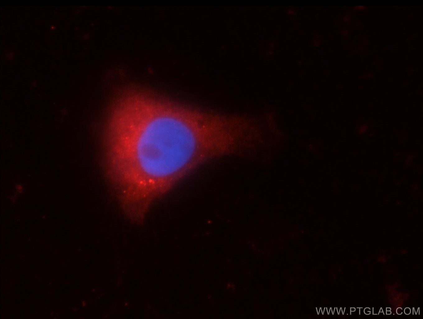 Immunofluorescence (IF) / fluorescent staining of SH-SY5Y cells using C9orf72 Polyclonal antibody (22637-1-AP)