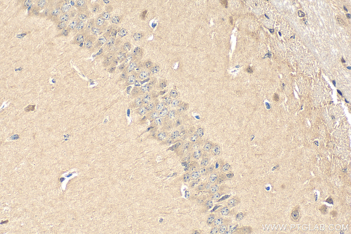 Immunohistochemistry (IHC) staining of mouse brain tissue using C9orf72 Polyclonal antibody (22637-1-AP)