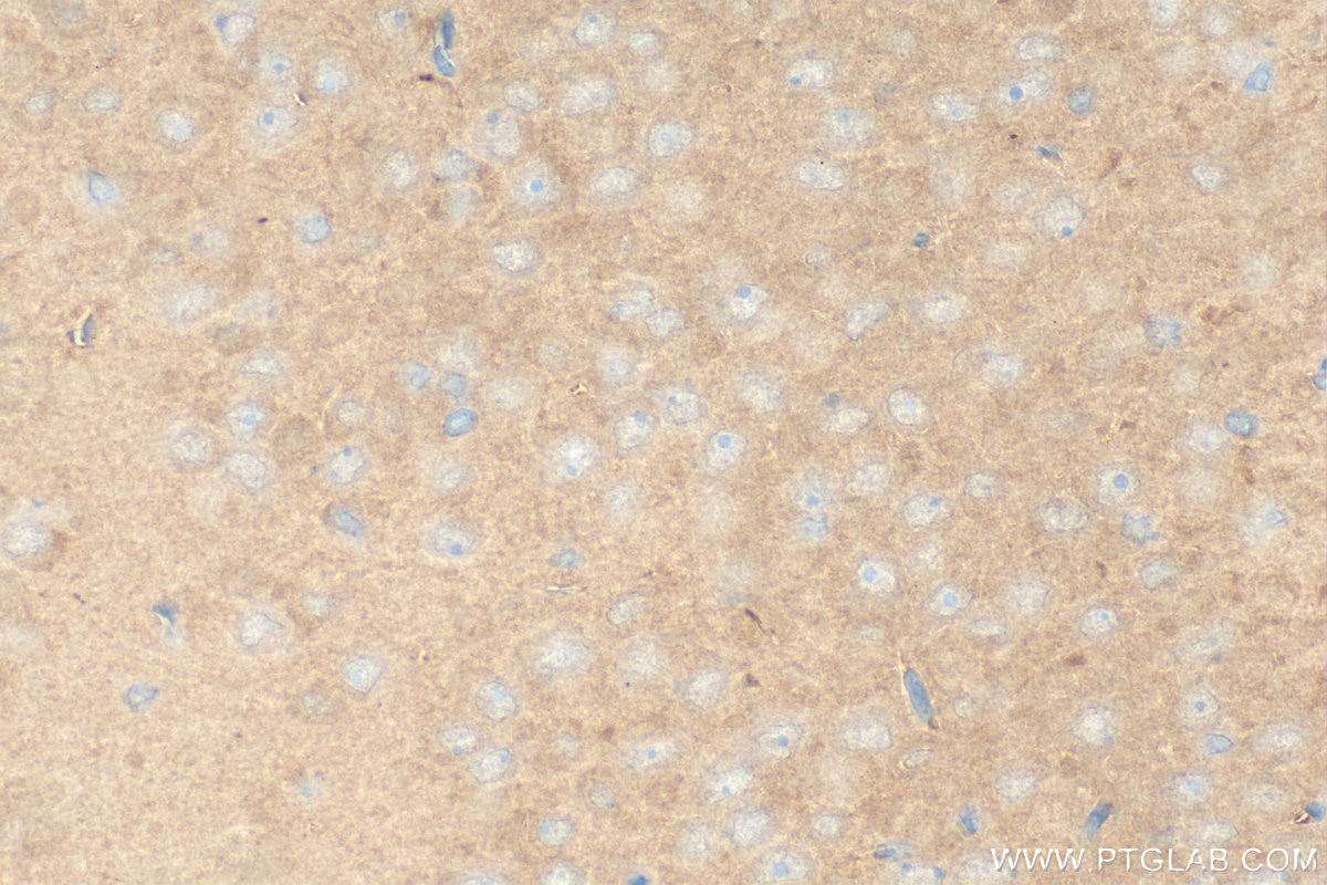 Immunohistochemistry (IHC) staining of rat brain tissue using C9orf72 Polyclonal antibody (22637-1-AP)