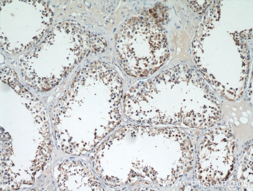 Immunohistochemistry (IHC) staining of human testis tissue using C9orf72 Polyclonal antibody (22637-1-AP)