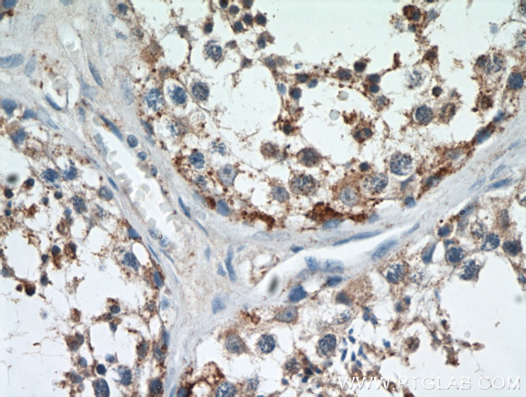 Immunohistochemistry (IHC) staining of human testis tissue using C9orf72 Polyclonal antibody (22637-1-AP)