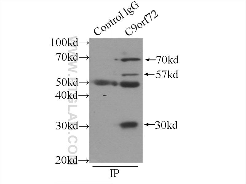 Immunoprecipitation (IP) experiment of SH-SY5Y cells using C9orf72 Polyclonal antibody (22637-1-AP)