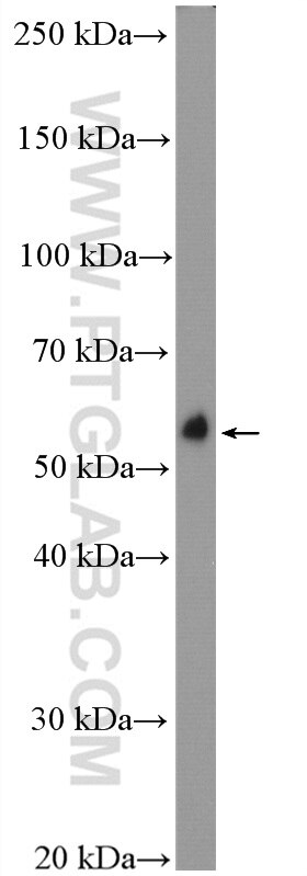 Western Blot (WB) analysis of rat brain tissue using C9orf72 Polyclonal antibody (22637-1-AP)
