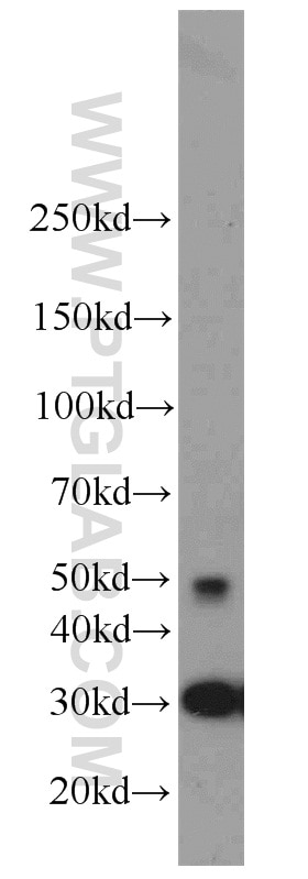 C9orf72 Polyclonal antibody