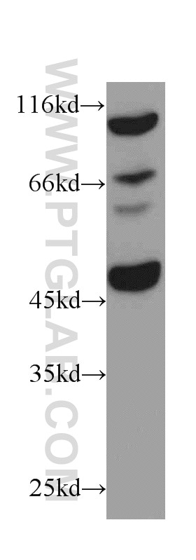 Western Blot (WB) analysis of SH-SY5Y cells using C9orf72 Polyclonal antibody (22637-1-AP)