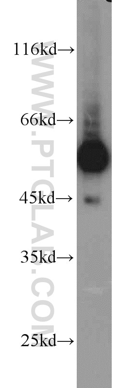 Western Blot (WB) analysis of Sp2/0 cells using C9orf72 Polyclonal antibody (22637-1-AP)