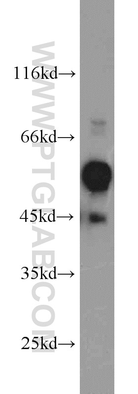 Western Blot (WB) analysis of mouse testis tissue using C9orf72 Polyclonal antibody (22637-1-AP)