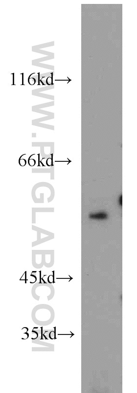 Western Blot (WB) analysis of HeLa cells using C9orf72 Polyclonal antibody (22637-1-AP)