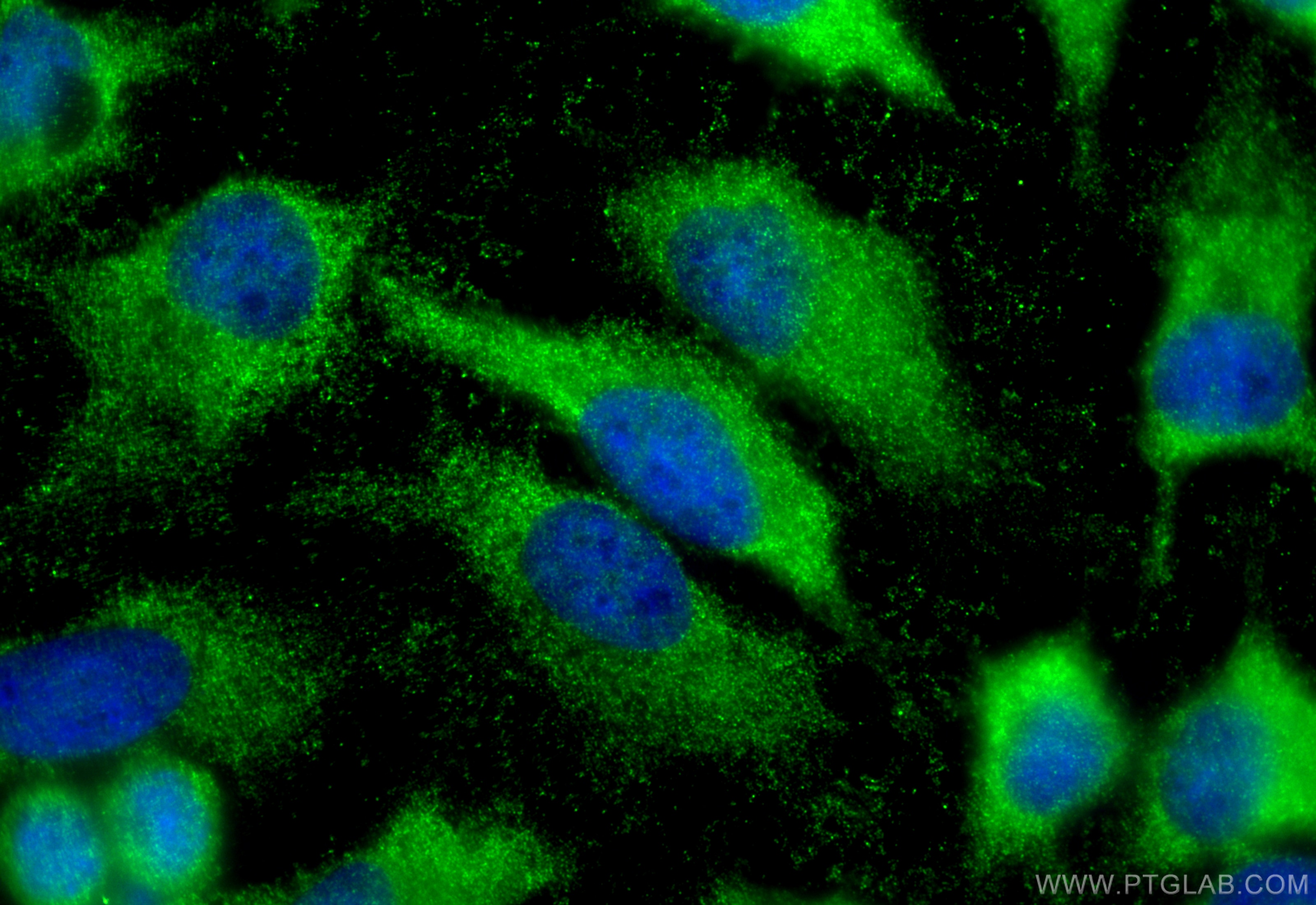Immunofluorescence (IF) / fluorescent staining of HeLa cells using C9orf72 Polyclonal antibody (25757-1-AP)