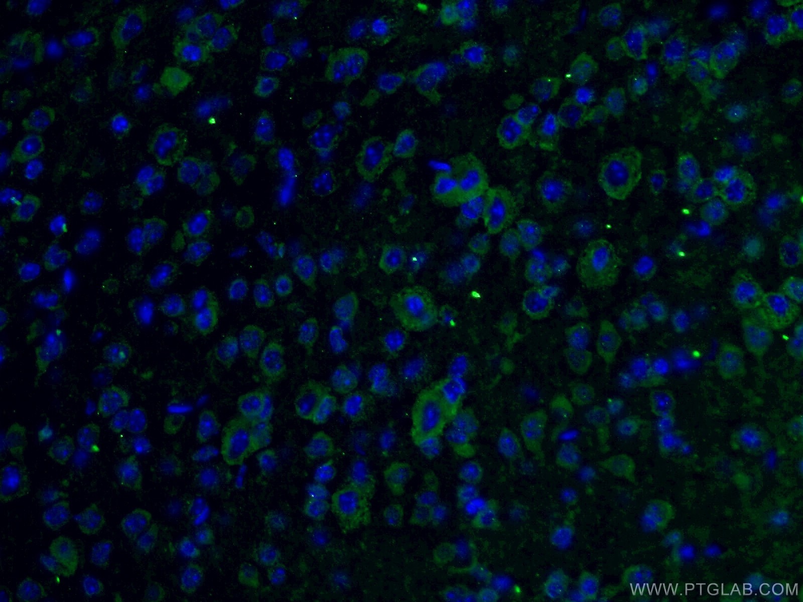 Immunofluorescence (IF) / fluorescent staining of mouse brain tissue using C9orf72 Polyclonal antibody (25757-1-AP)