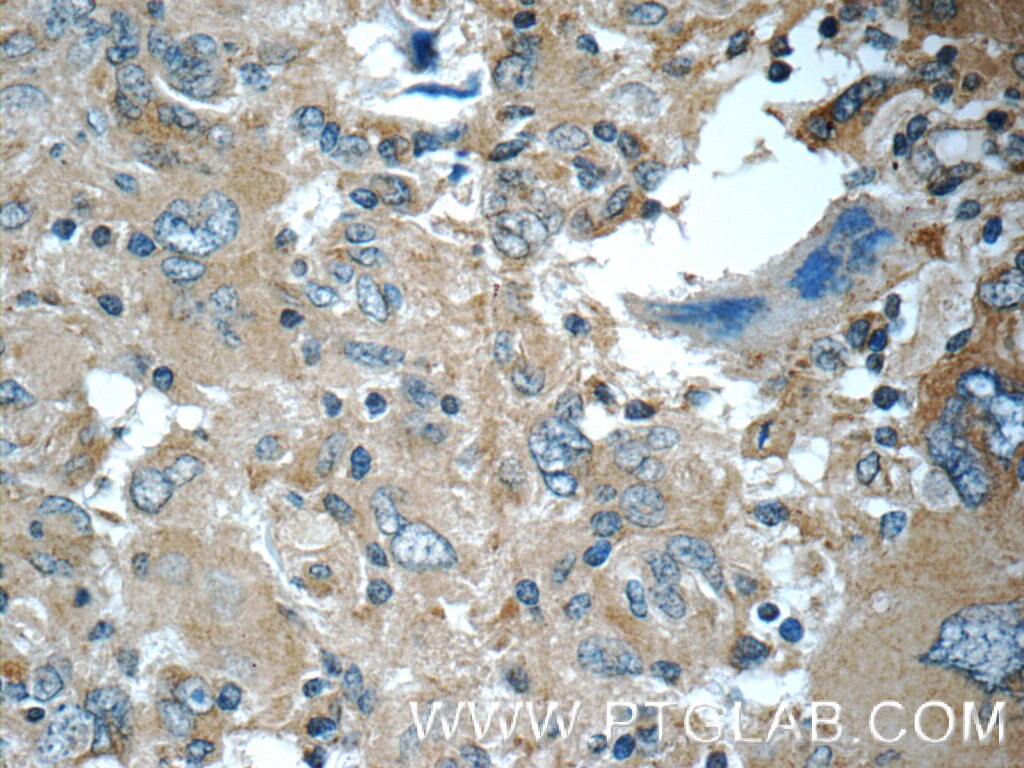 C9orf72 Polyclonal antibody