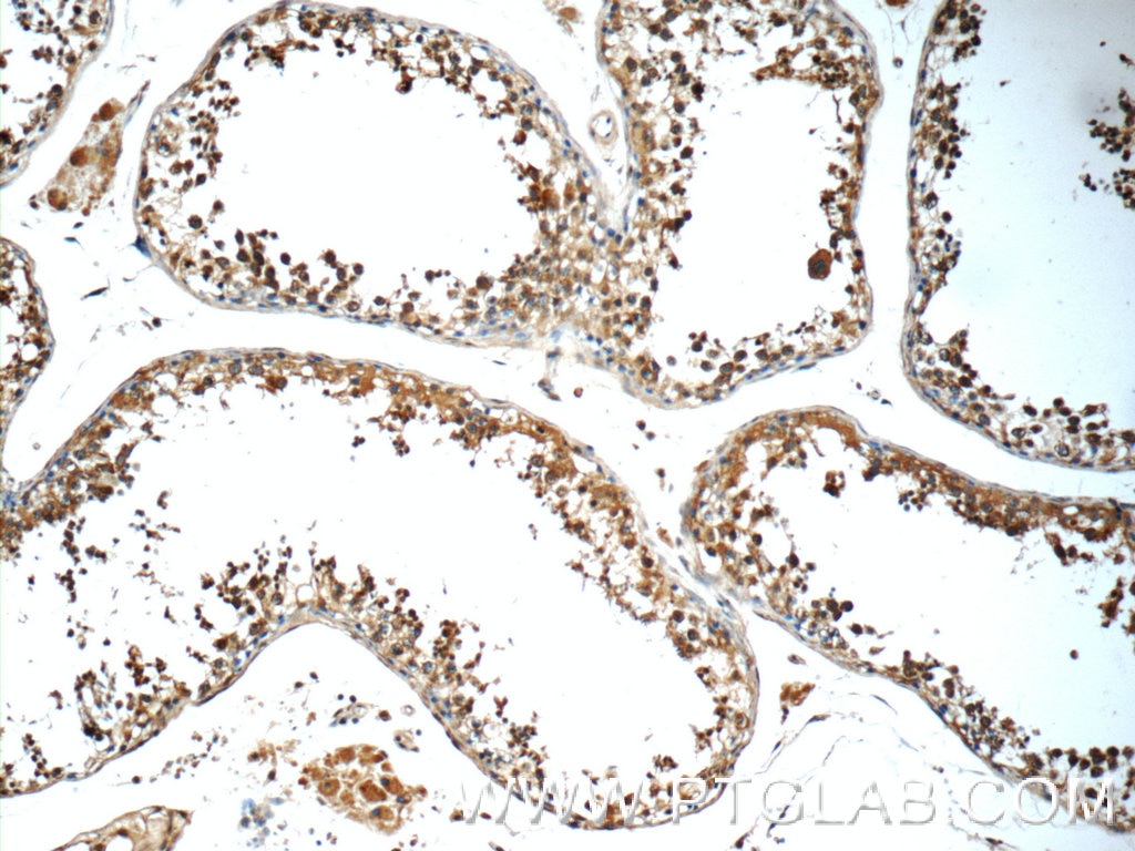 Immunohistochemistry (IHC) staining of human testis tissue using C9orf72 Polyclonal antibody (25757-1-AP)