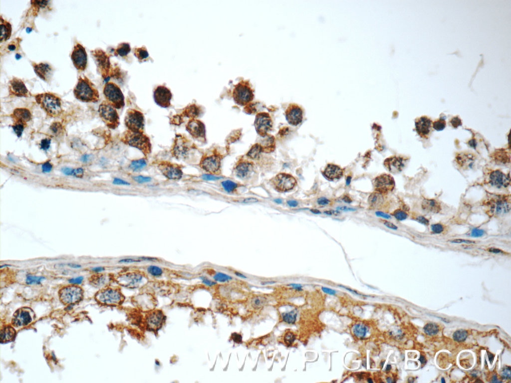 Immunohistochemistry (IHC) staining of human testis tissue using C9orf72 Polyclonal antibody (25757-1-AP)