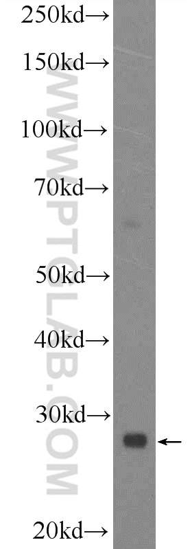 WB analysis of SH-SY5Y using 25757-1-AP