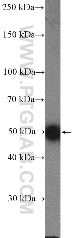 Western Blot (WB) analysis of mouse brain tissue using C9orf72 Polyclonal antibody (25757-1-AP)