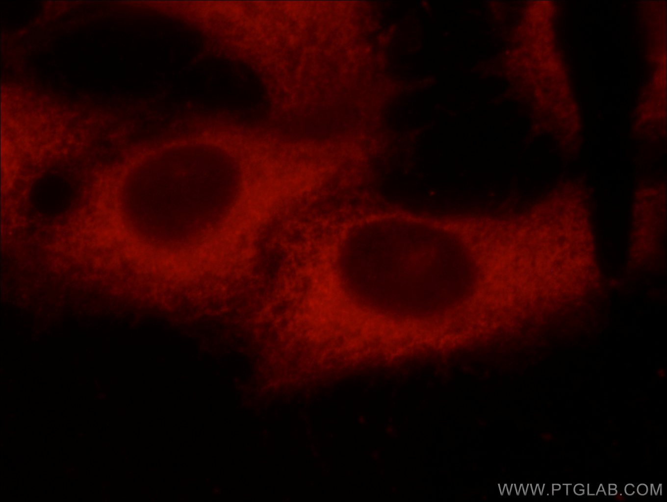 Immunofluorescence (IF) / fluorescent staining of SH-SY5Y cells using C9orf72 Monoclonal antibody (66140-1-Ig)