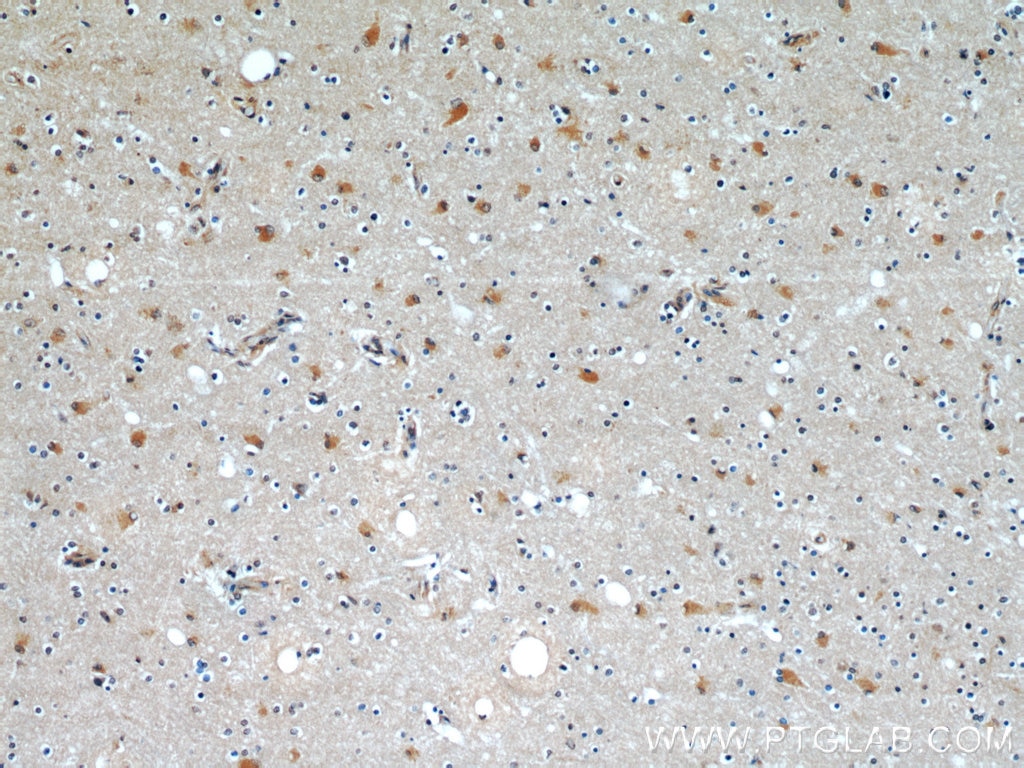 Immunohistochemistry (IHC) staining of human brain tissue using C9orf72 Monoclonal antibody (66140-1-Ig)