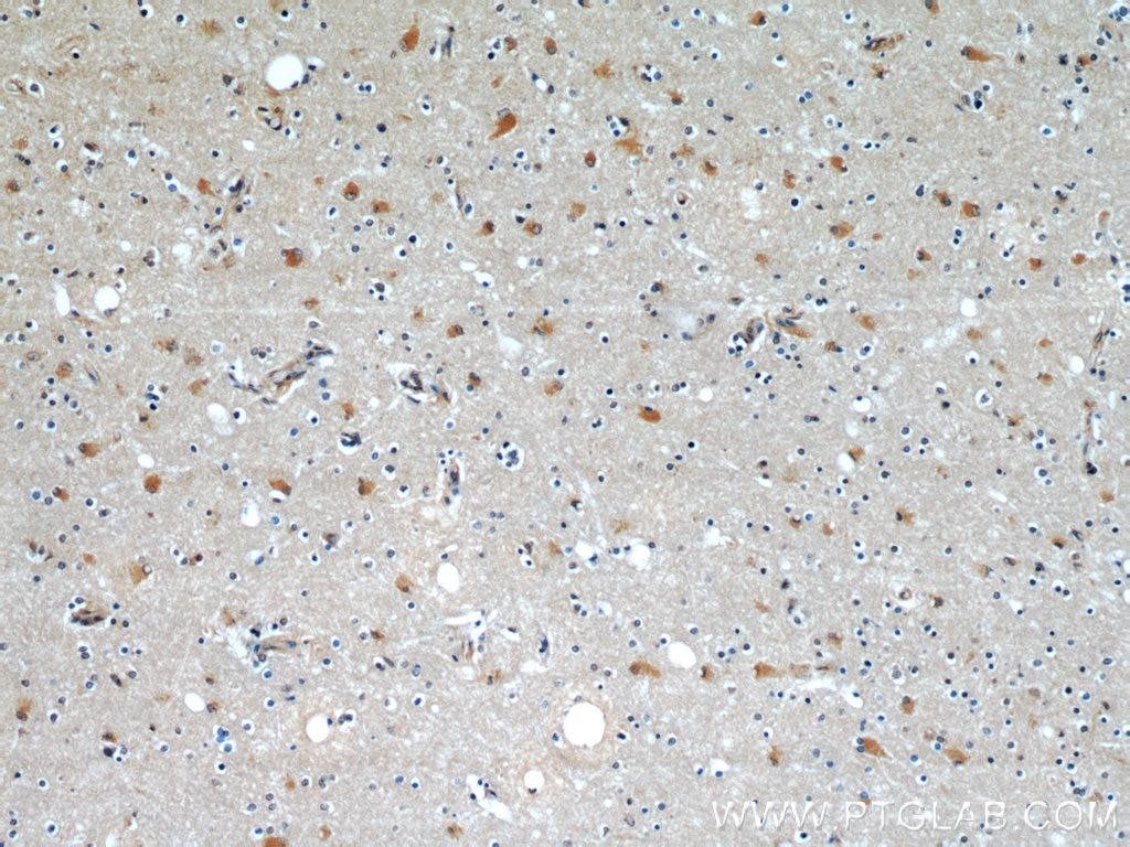 IHC staining of human brain using 66140-1-Ig