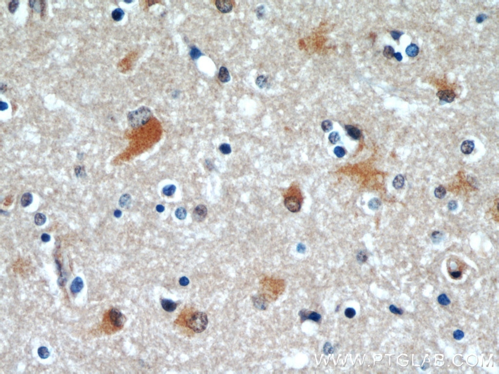 Immunohistochemistry (IHC) staining of human brain tissue using C9orf72 Monoclonal antibody (66140-1-Ig)